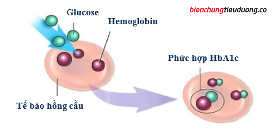 HbA1c trong chẩn đoán và điều trị biến chứng tiểu đường