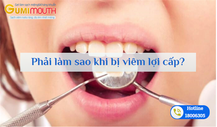   Người bị viêm lợi cấp nên kiểm tra răng miệng định kỳ
