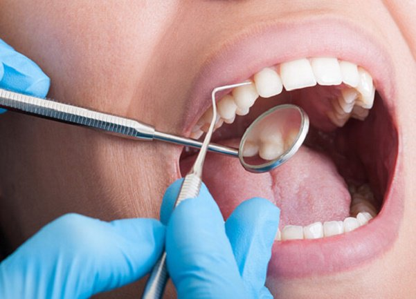 Khám răng định kỳ giúp cải thiện tình trạng sưng lợi chảy máu chân răng