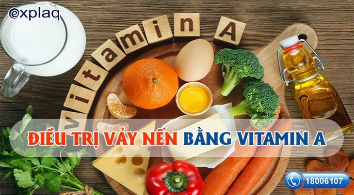   Điều trị vảy nến bằng vitamin A