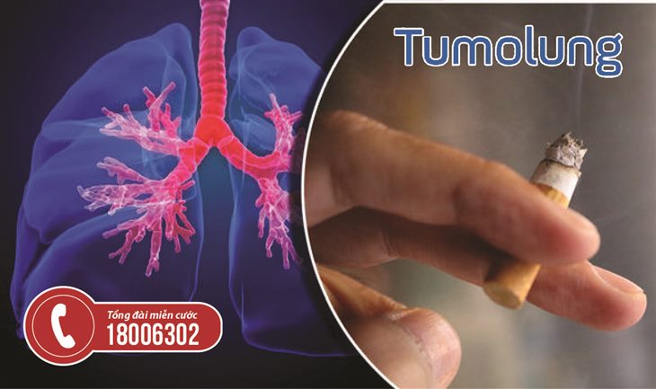 Ung thư phổi là bệnh lý nguy hiểm cần phát hiện sớm