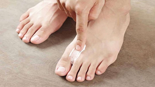 Da khô có thể là nguyên nhân gây bệnh á sừng ở ngón chân
