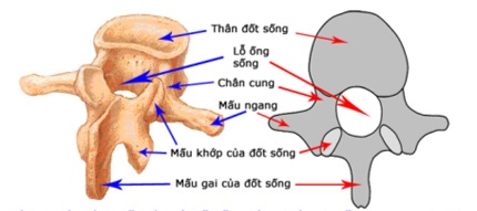 Gai cột sống có cần phẫu thuật?