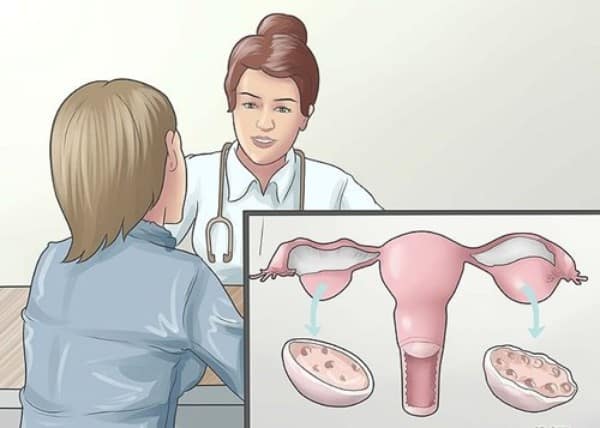 Bị viêm buồng trứng có thai được không?