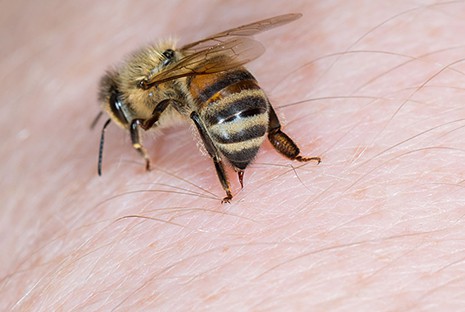 Khi ong đốt, nó sẽ để lại kim và túi chứa nọc độc trên da