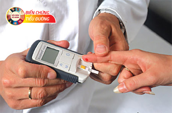 Kiểm tra đường huyết xác định chính xác bệnh tiểu đường