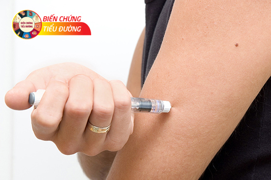 Tiêm insulin đúng cách sẽ mang lại hiệu quả điều trị cao