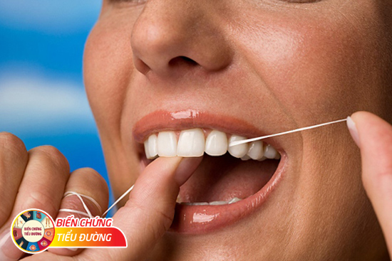 Sử dụng chỉ nha khoa để chăm sóc răng miệng hàng ngày