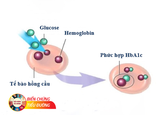 Sự gắn kết hemoglobin với glucose tạo thành phức hợp HbA1c