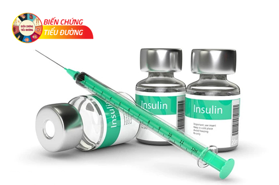Tiêm insulin giúp tăng hiệu quả điều trị  bệnh tiểu đường type 2