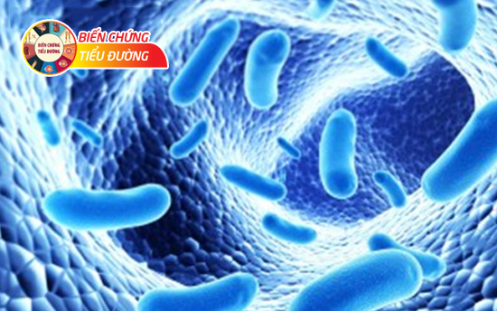 Bổ sung lợi khuẩn Probiotic sớm giúp thiết lập một hệ vi khuẩn có ích cho cơ thể