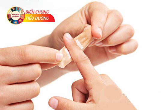 Băng vết thương dù nhỏ nhất bằng gạc mềm giúp hạn chế nguy cơ nhiễm trùng do tiểu đường