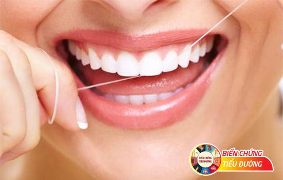 Dùng chỉ nha khoa giúp hạn chế tổn thương nướu răng trong bệnh tiểu đường