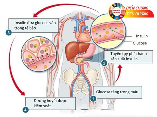 Vai trò của insulin trong việc kiểm soát đường huyết