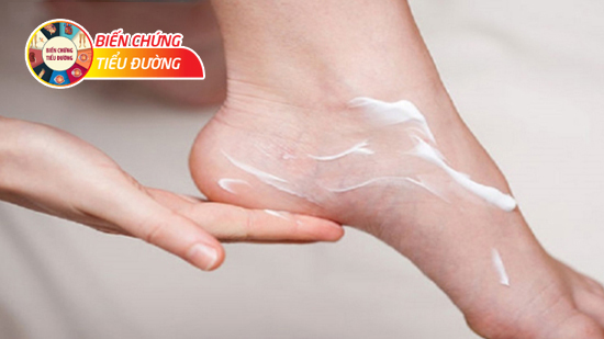 Thoa kem dưỡng ẩm cho bàn chân