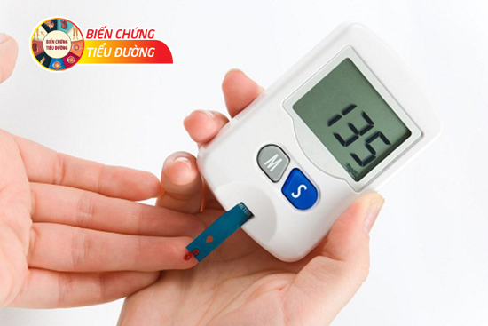 Bệnh tiểu đường được đặc trưng bởi nồng độ đường trong máu tăng cao