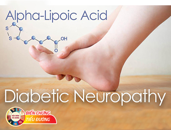 Alpha lipoic acid giúp phòng và điều trị hiệu quả biến chứng thần kinh tiểu đường.