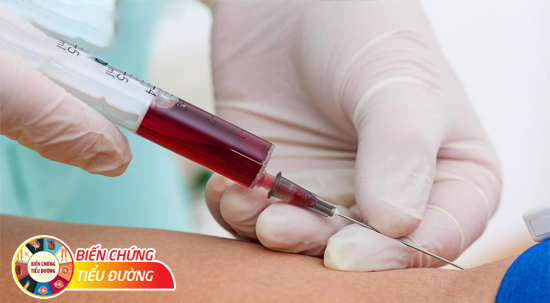 Xét nghiệm máu HbA1c là gì? Vì sao quan trọng với người bệnh tiểu đường?