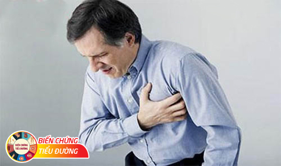Đau thắt ngực do biến chứng tiểu đường tim mạch.