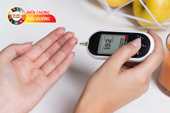 Người tiểu đường cần kiểm soát cả chỉ số đường huyết, huyết áp và mỡ máu