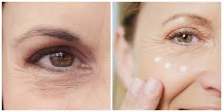 mắt là vùng da thường xuất hiện nếp nhăn sớm