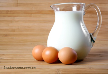 Trứng và sữa là 2 thực phẩm phổ biến có liên quan đến bệnh chàm