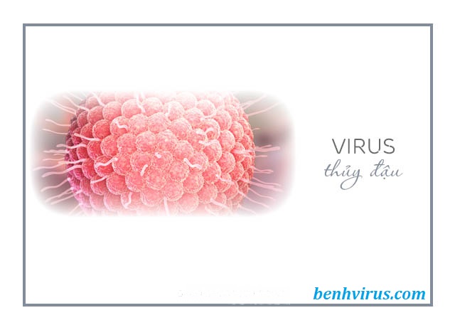 Virus gây bệnh thủy đậu