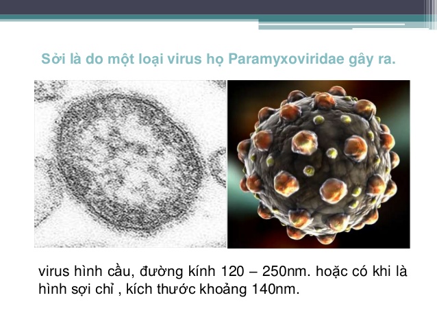 Hình ảnh virus gây bệnh sởi