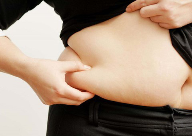 Người bị béo phì, thừa cân thường phát triển tổn thương vảy nến tại các nếp gấp da