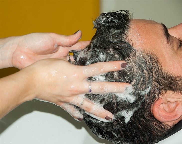 Một số loại dầu gội đầu có thể cải thiện tình trạng vảy nến da đầu