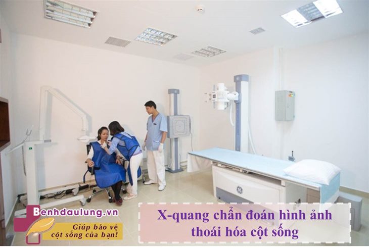 Vai trò của X-quang trong chẩn đoán hình ảnh thoái hóa cột sống