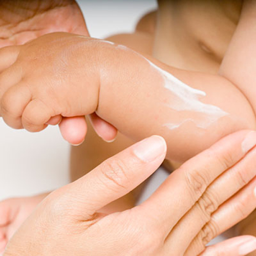 Dưỡng ẩm cho bé bị chàm sữa là rất quan trọng
