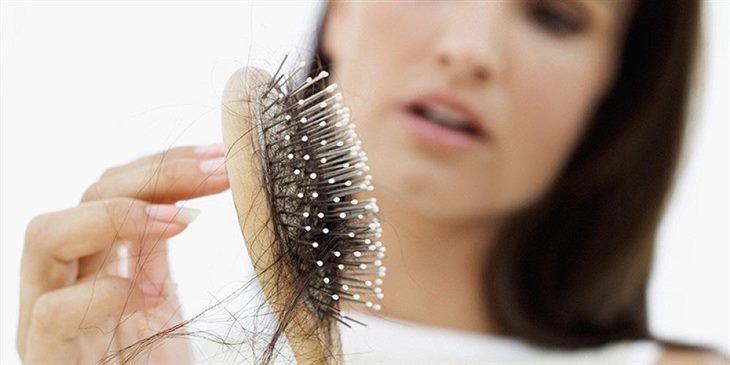 Rụng tóc là tình trạng phổ biến ở người bị lupus ban đỏ