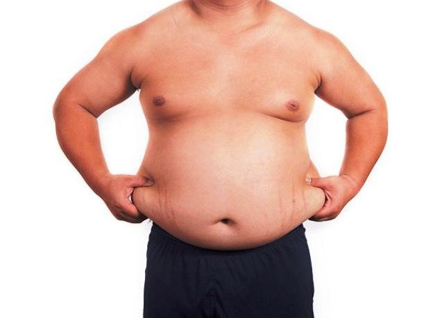 Thừa cân, béo phì làm tăng nguy cơ mắc vảy nến