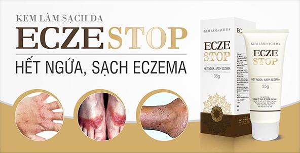Eczestop - Kem làm sạch da giúp cải thiện viêm da dị ứng