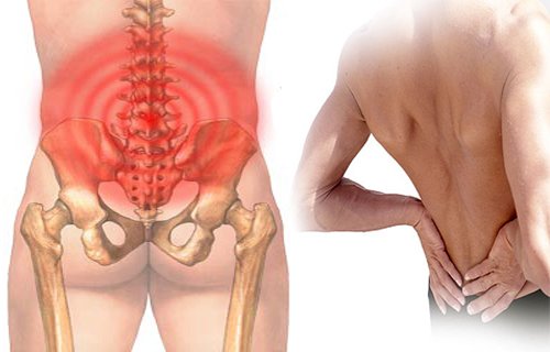 Các cơn đau nhức khi bị thoái hóa cột sống thắt lưng