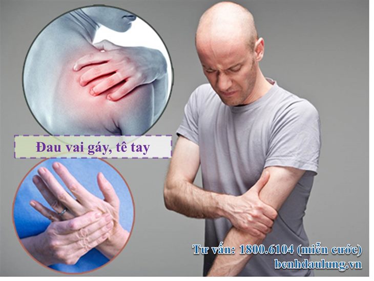 Đau vai gáy, tê tay là triệu chứng thường gặp