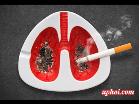 Bệnh u phổi ác tính không chỉ do hút thuốc lá