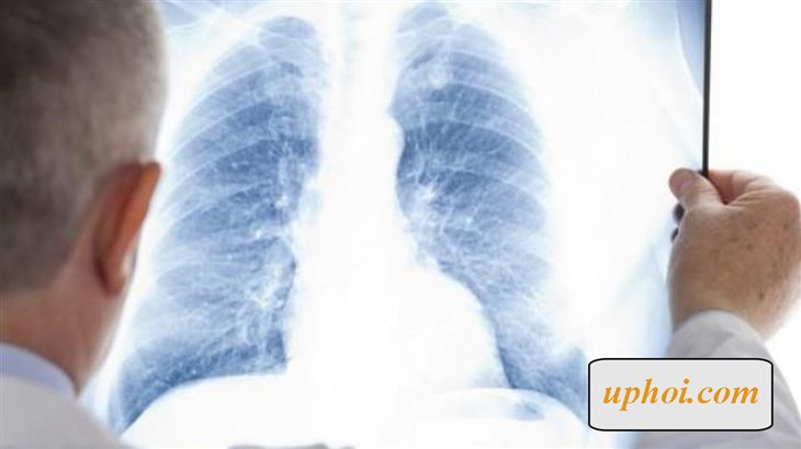 U phổi có chữa được không?