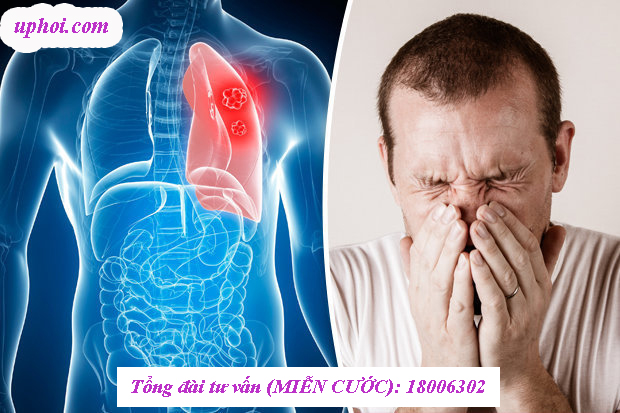 U phổi là bệnh phát triển thầm lặng ít triệu chứng