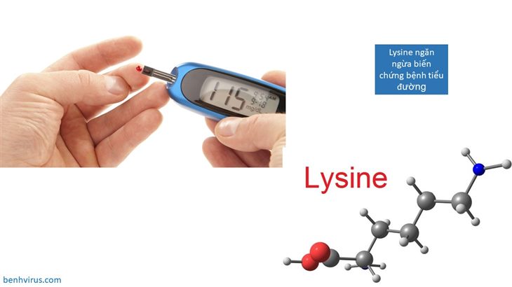 Lysine ngăn biến chứng bệnh tiểu đường