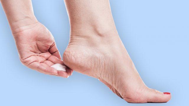 Các loại thuốc, kem thoa trên da được sử dụng phổ biến để điều trị bệnh vảy nến ở chân