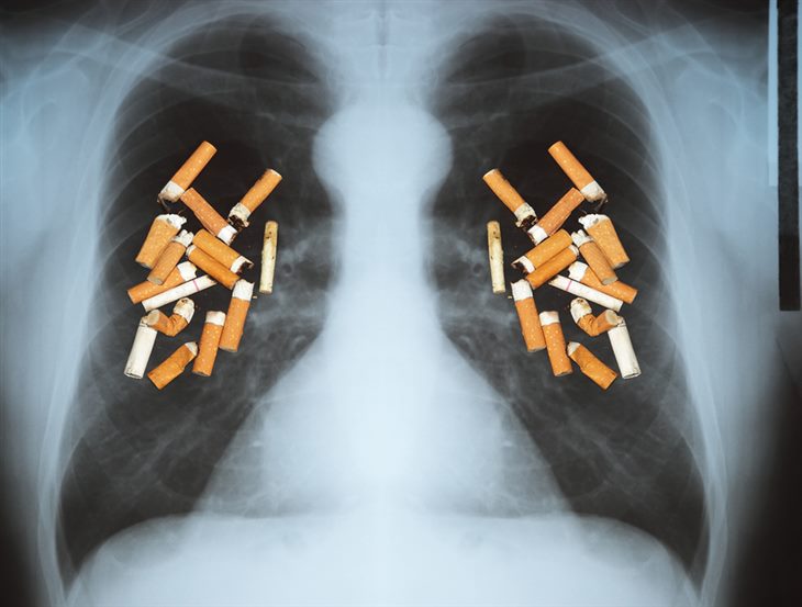 Ngừng hút thuốc lá giúp giảm nguy cơ mắc u phổi