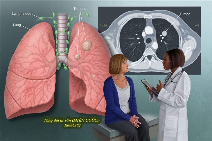 Bị u ở phổi có chữa được không?