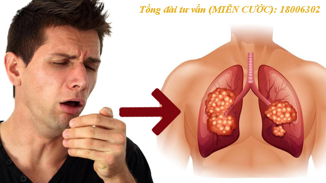 U phổi trái có thể biểu hiện bằng nhiều triệu chứng