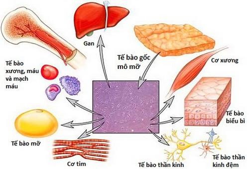 Các tế bào gốc được sử dụng trong liệu pháp chữa bệnh lupus