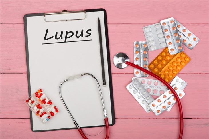 Đa số thuốc điều trị lupus đều gây ra một số tác dụng phụ nhất định