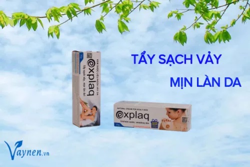 Explaq hỗ trợ điều trị vảy nến ở mí mắt hiệu quả, an toàn