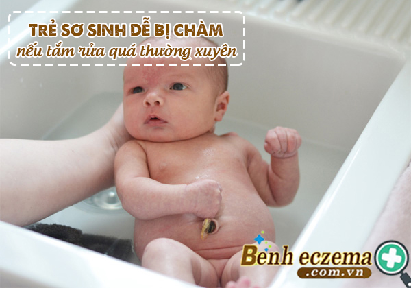 Trẻ sơ sinh dễ bị chàm nếu tắm rửa quá thường xuyên