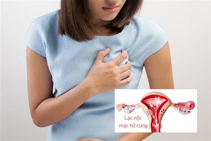 Phụ nữ mắc lạc nội mạc tử cung tăng nguy cơ bị các bệnh tim mạch